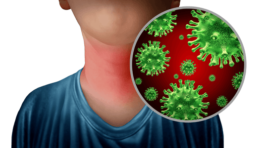 What is a Pharyngitis (sore throat)?